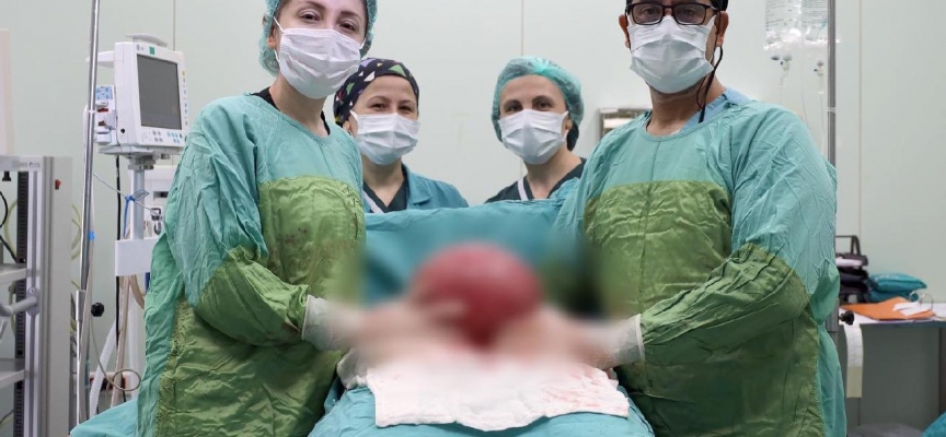 Karabük'te hastanın karnından 3 kilo 750 gram ur çıktı